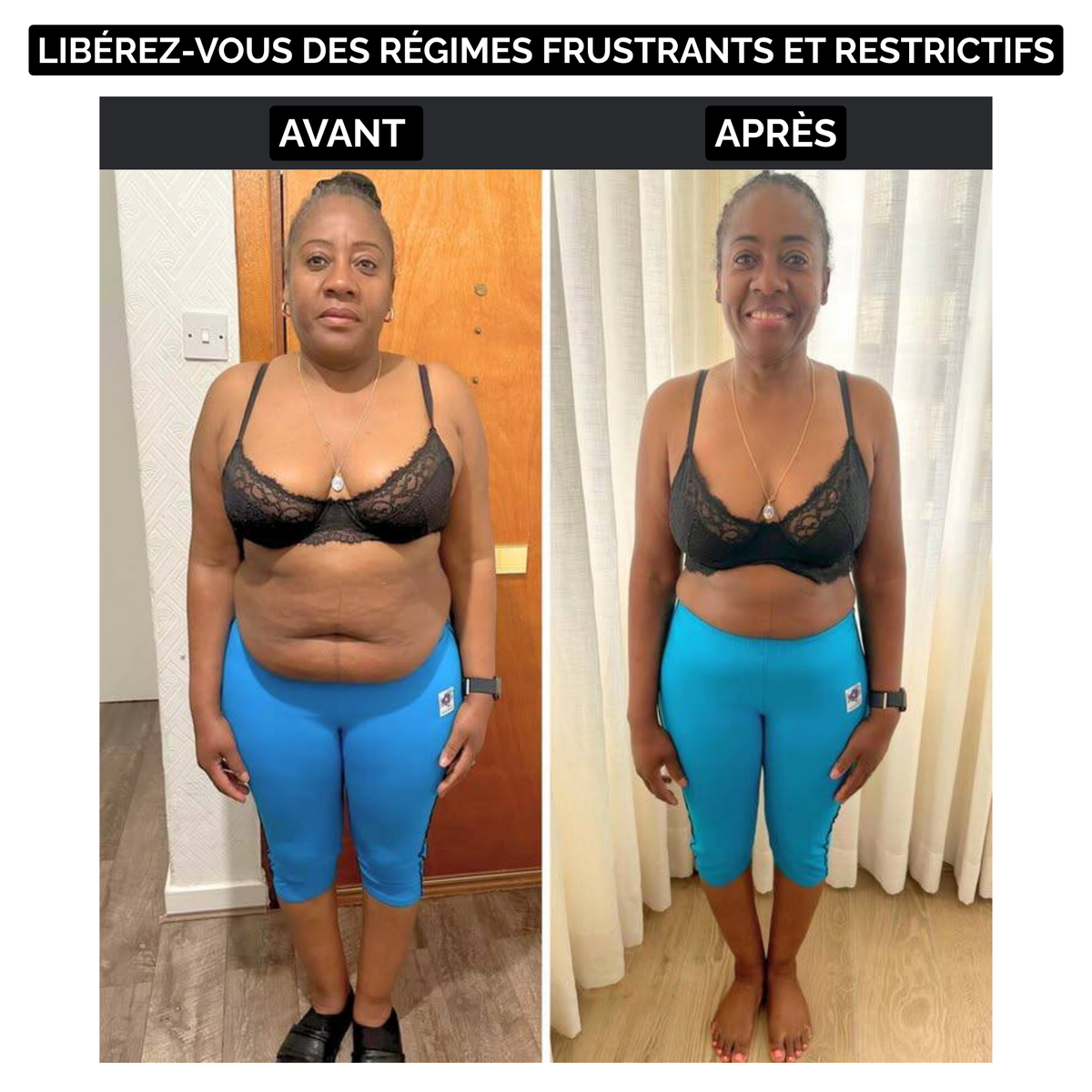 Slim Patch - Affinez votre silhouette sans sport ni régime